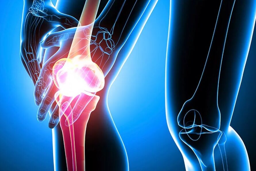 Osteoartrite do xeonllo