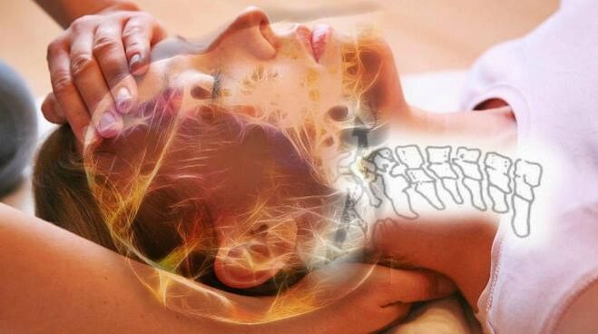 Cambios dexenerativos nas franxas vertebrais para osteocondrose cervical