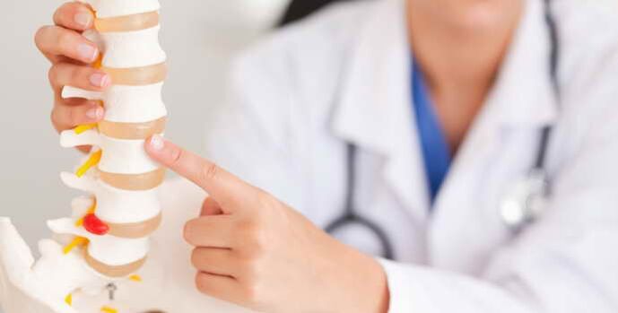 A osteocondrose é unha enfermidade espinal