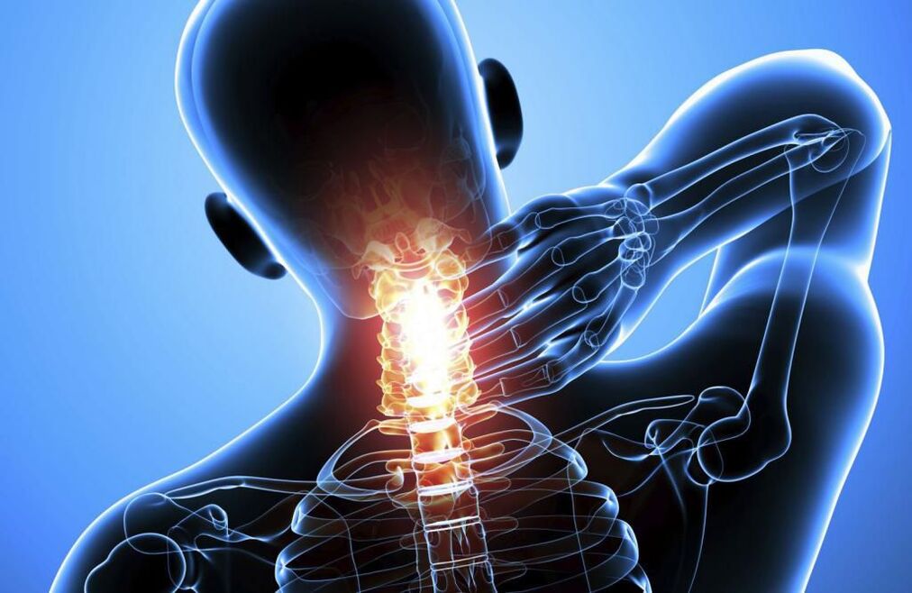 Osteocondrose da columna cervical