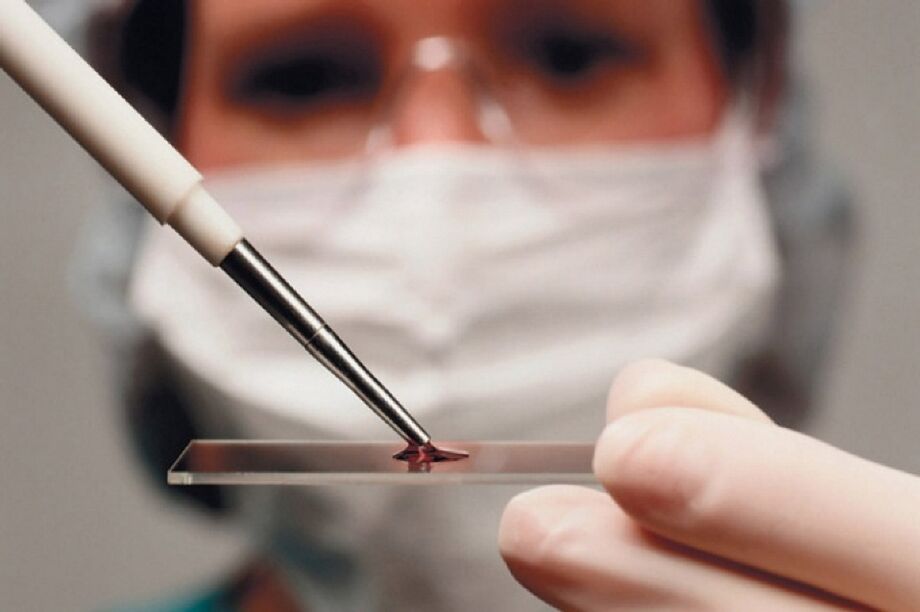A artrite é unha enfermidade inflamatoria cuxa presenza se determina mediante análises de sangue.